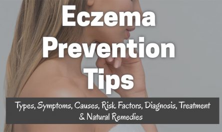 tips for eczema prevention